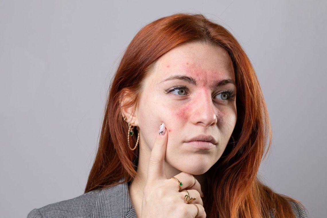 Skriti znaki stresa, ki jih pogosto spregledamo